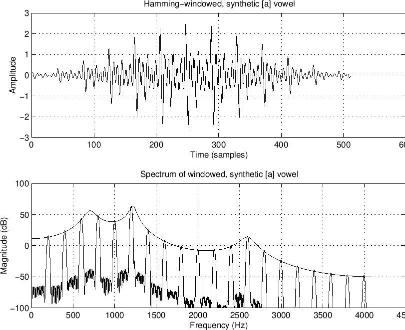 \includegraphics[width=\textwidth ]{eps/Speech}